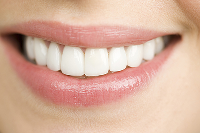 Close up of woman smiling iStock 000029740356 Large width of 400 pixels