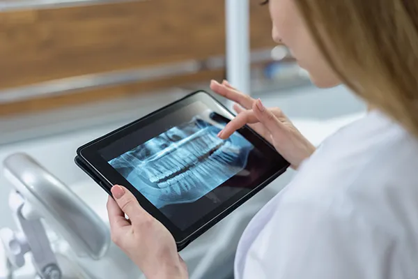 image of digital xrays AdobeStock 482660064