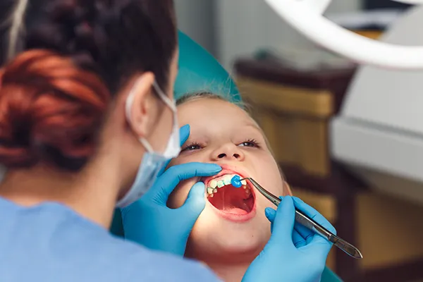 image of fluoride treatment AdobeStock 525595413