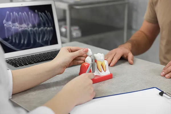 A dentist using a dental implant model to explain the procedure to a patient at Riverwind Dental in Henrico, VA