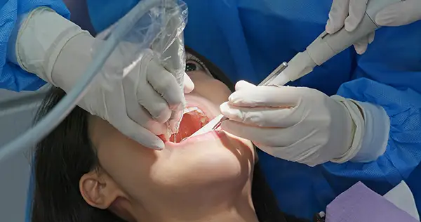 Dentist performing a root canal treatment on a patient at Riverwind Dental in Henrico, VA