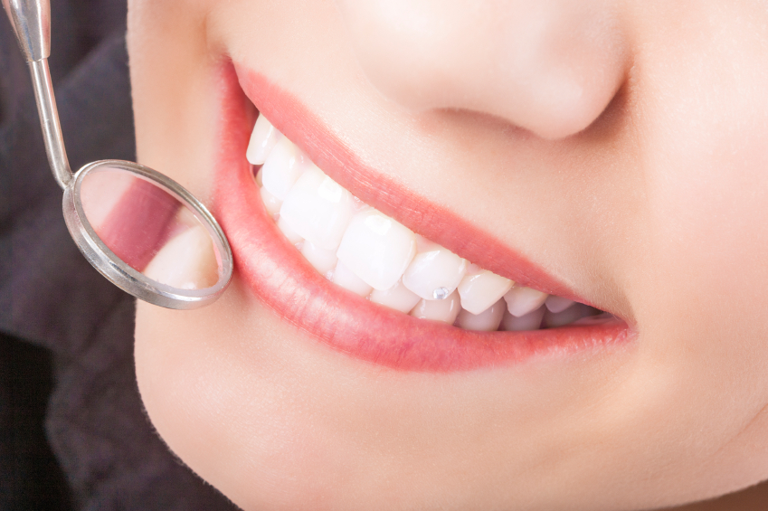 What Are Dental Sealants?